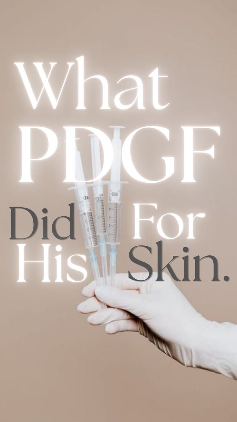 Post 4 by Dr. Mariano Busso | Cosmetic Dermatology on Instagram (video)