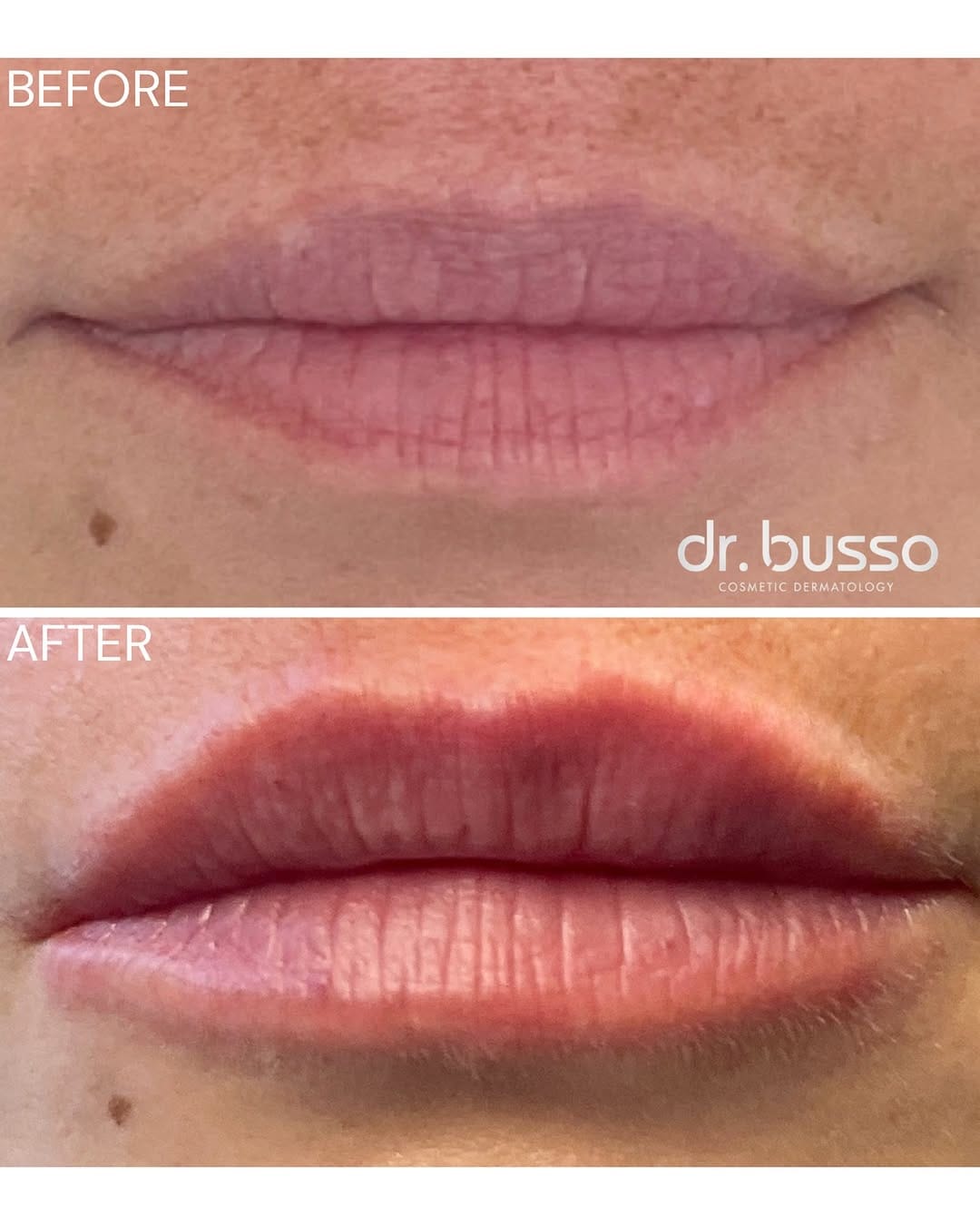 Post 7 by Dr. Mariano Busso | Cosmetic Dermatology on Instagram (image)