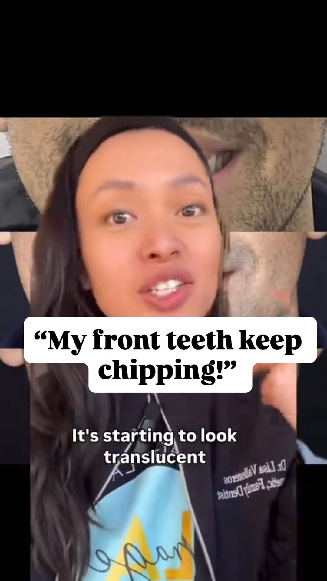 Post 1 by Dr. Lisa Vallesteros | Cosmetic & Family Dentist on Instagram (video)