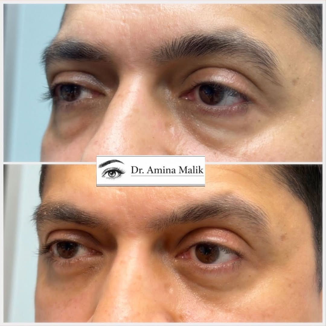 Post 1 by Dr. Amina I. Malik MD on Instagram (carousel)