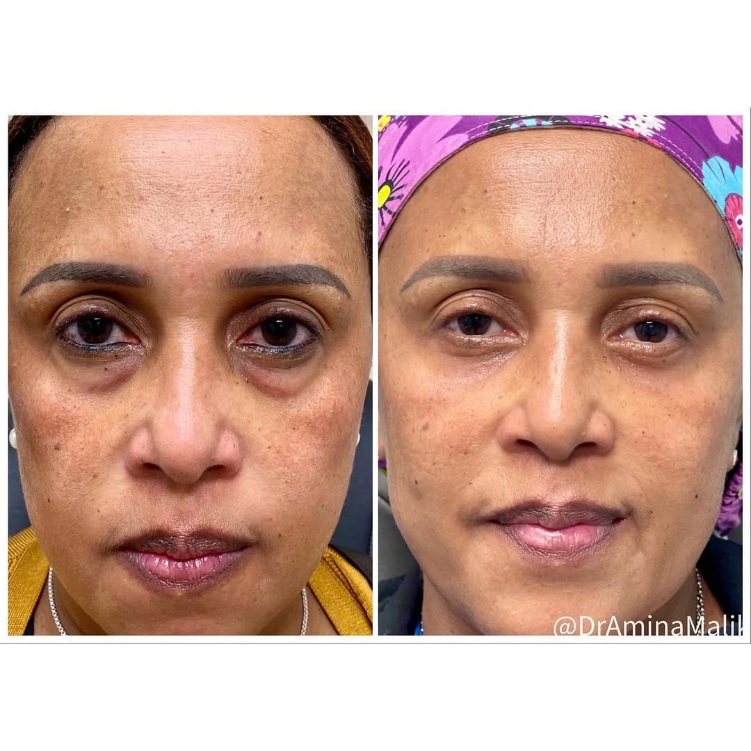 Post 9 by Dr. Amina I. Malik MD on Instagram (image)