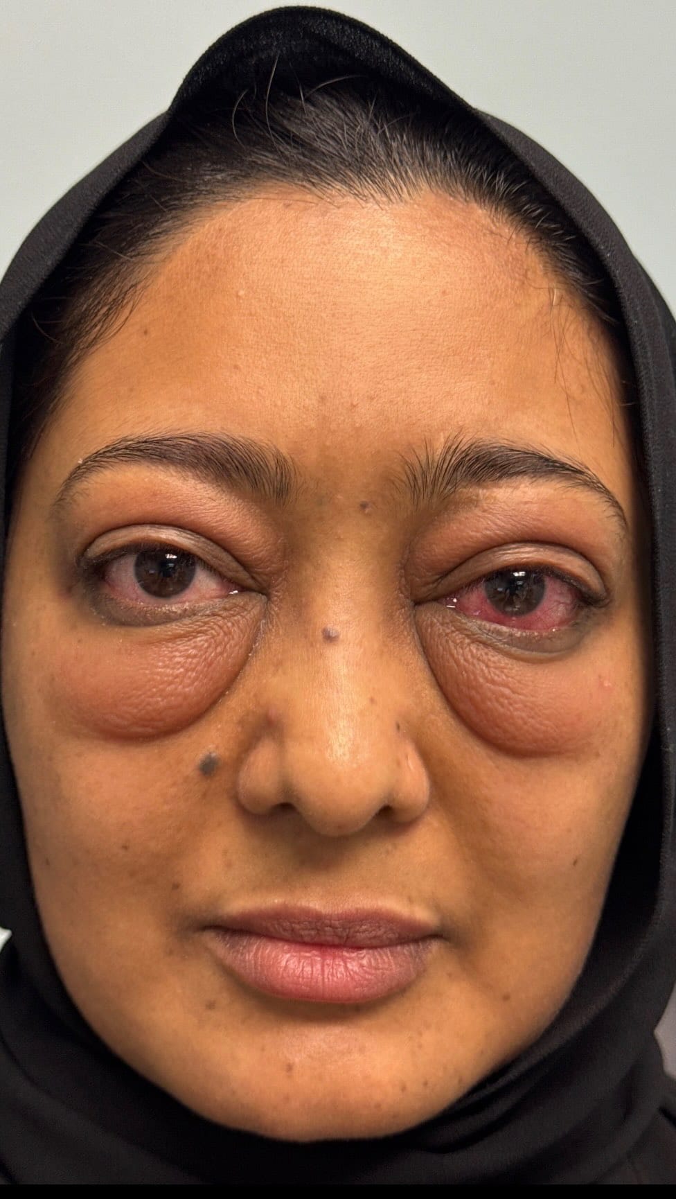Post 3 by Dr. Amina I. Malik MD on Instagram (video)