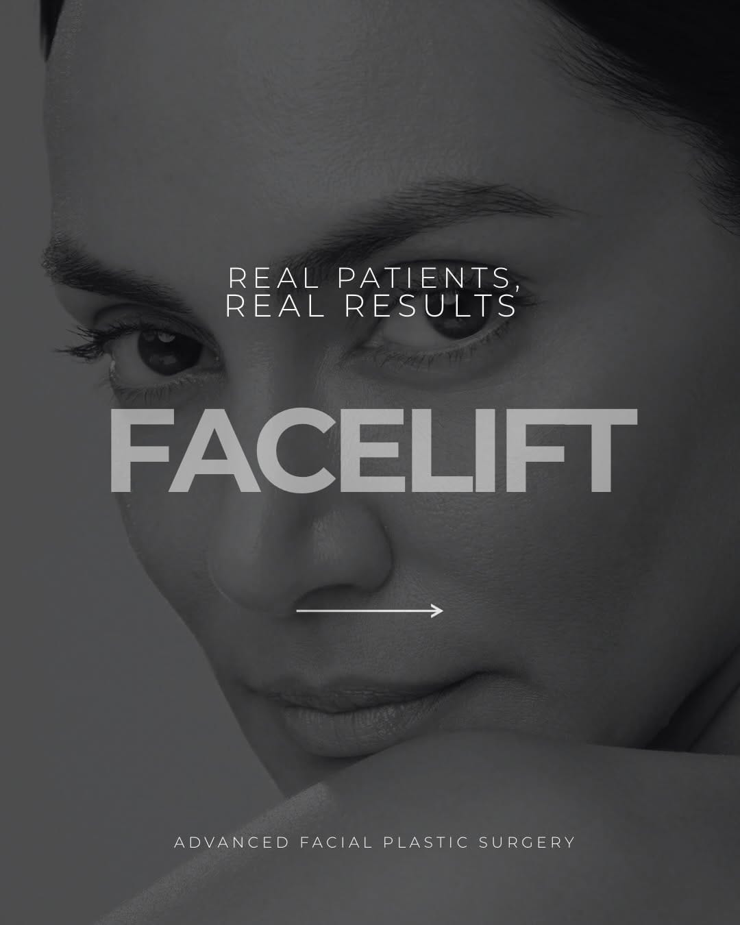 Post 1 by Advanced Facial Plastic Surgery Center/Med Spa on Instagram (carousel)