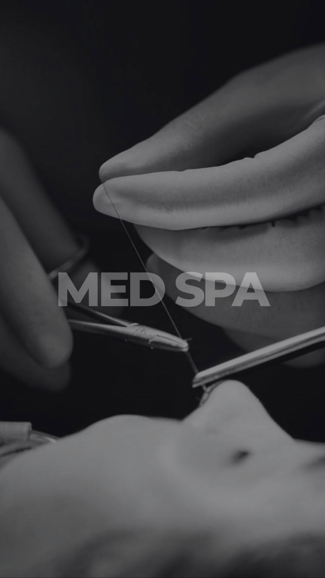 Post 10 by Advanced Facial Plastic Surgery Center/Med Spa on Instagram (video)