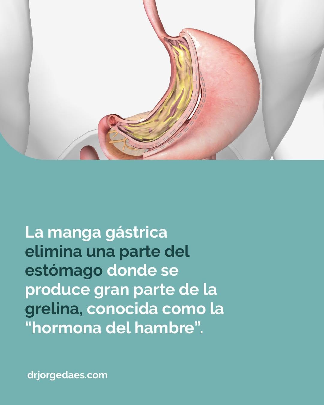 Post 3 by JORGE DAES MD FACS on Instagram (image)