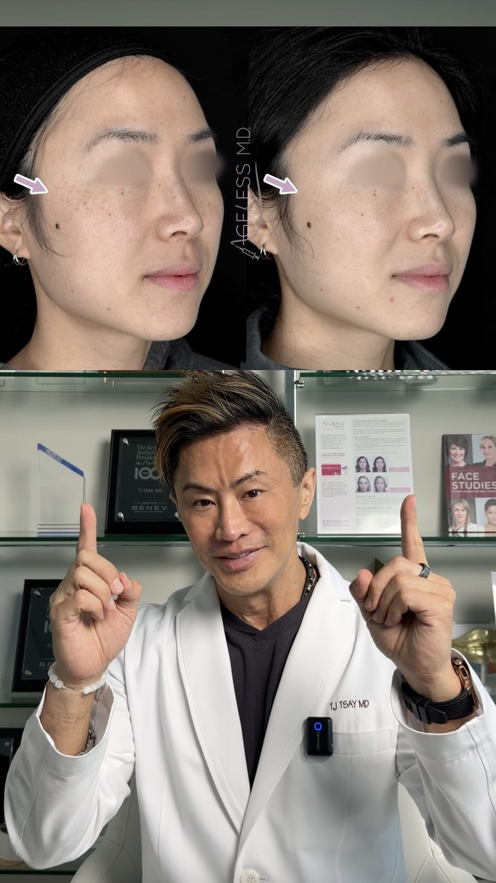 Post 6 by AGELESS MD LA & OC MEDSPA on Instagram (video)