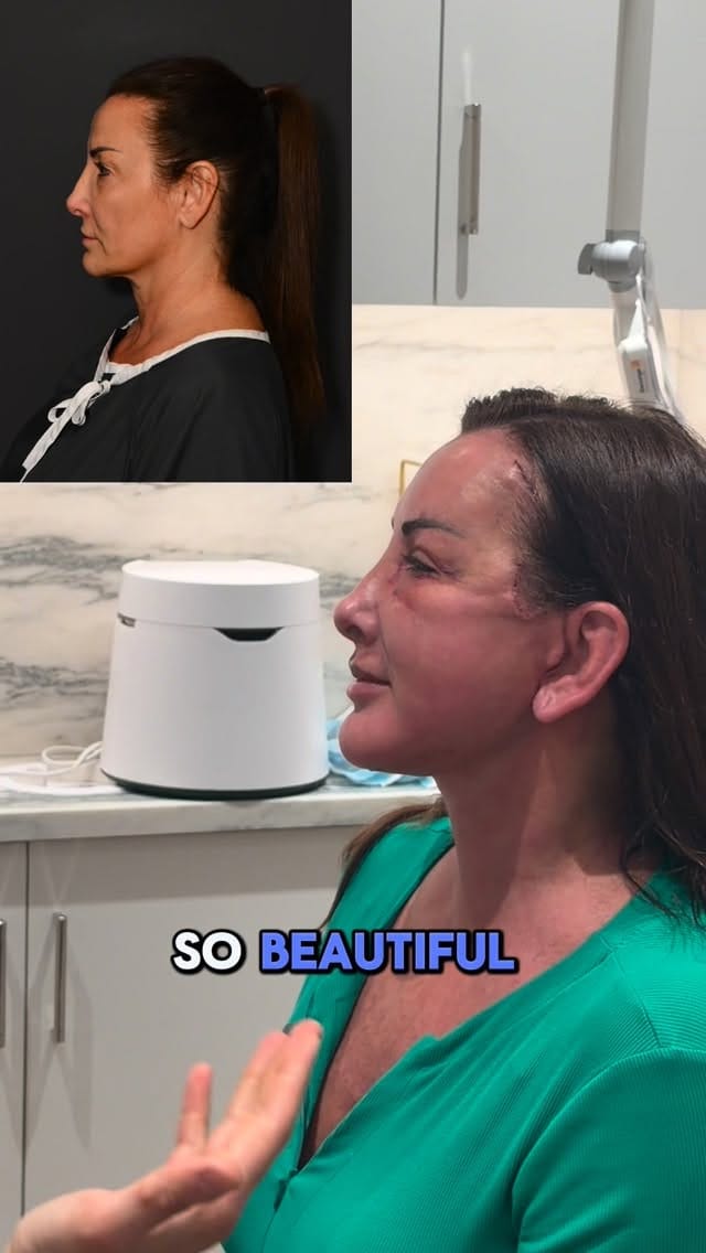 Post 7 by Sean Alemi, MD, FACS on Instagram (video)