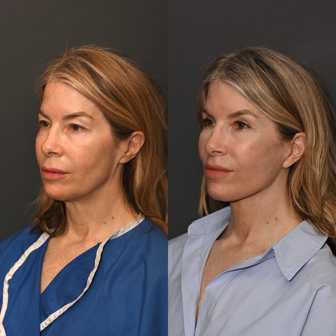 Post 3 by Sean Alemi, MD, FACS on Instagram (image)