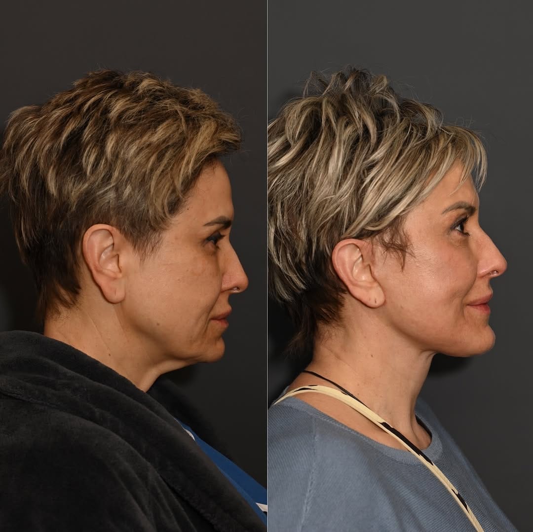 Post 6 by Sean Alemi, MD, FACS on Instagram (image)