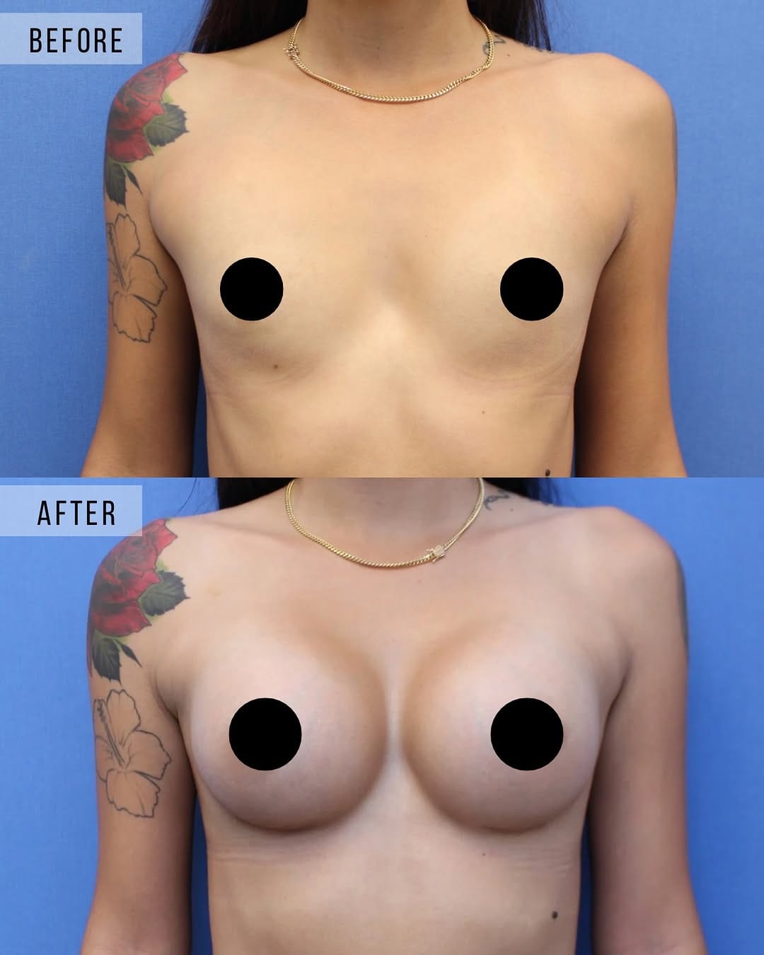Post 4 by Jason I Altman MD on Instagram (image)