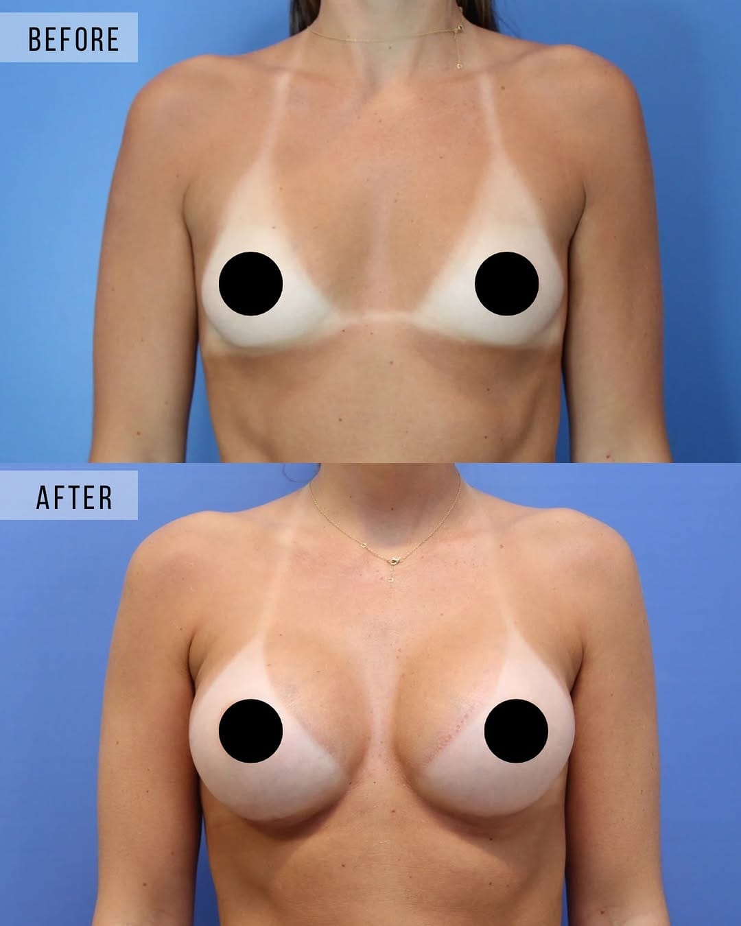 Post 8 by Jason I Altman MD on Instagram (image)