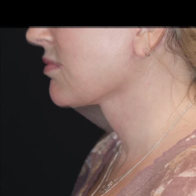Post 3 by Elizabeth Chance, MD on Instagram (video)