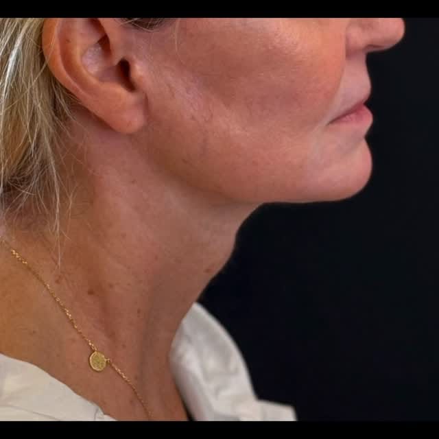 Post 8 by J. Simon Ivey M.D. on Instagram (video)