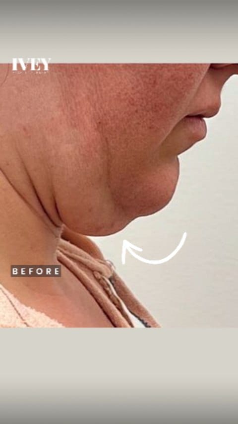 Post 10 by J. Simon Ivey M.D. on Instagram (video)