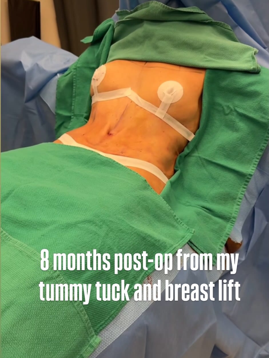 Post 1 by Dr Martin Jugenburg (Dr6ix) - Plastic Surgeon on Instagram (carousel)