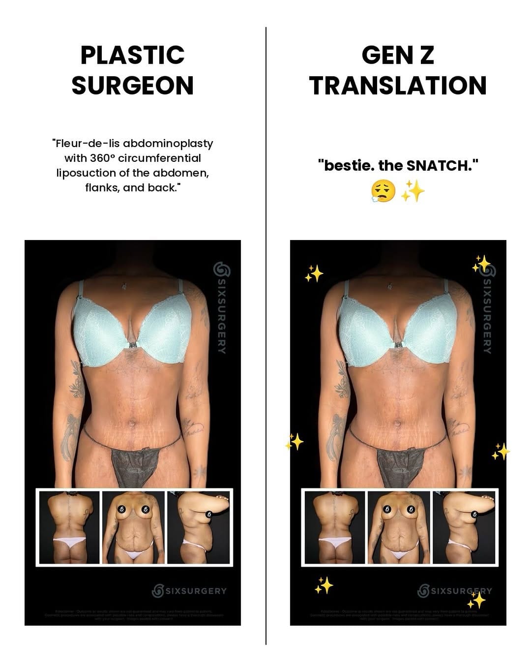 Post 5 by Dr Martin Jugenburg (Dr6ix) - Plastic Surgeon on Instagram (image)