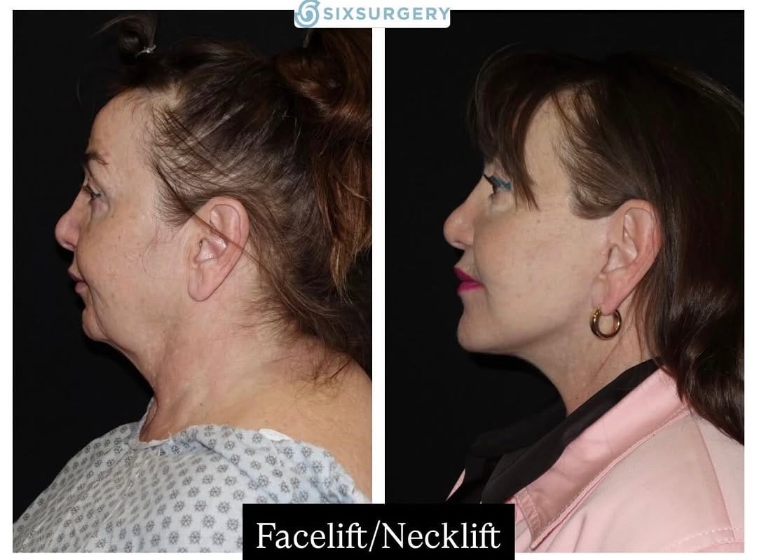 Post 4 by Dr Martin Jugenburg (Dr6ix) - Plastic Surgeon on Instagram (image)