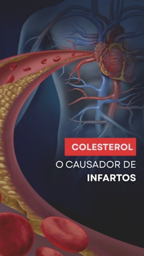 Post 8 by Dr. Ureliano Cintra | Cardiologista CRM 106610 RQE 24722 - 24721 on Instagram (video)