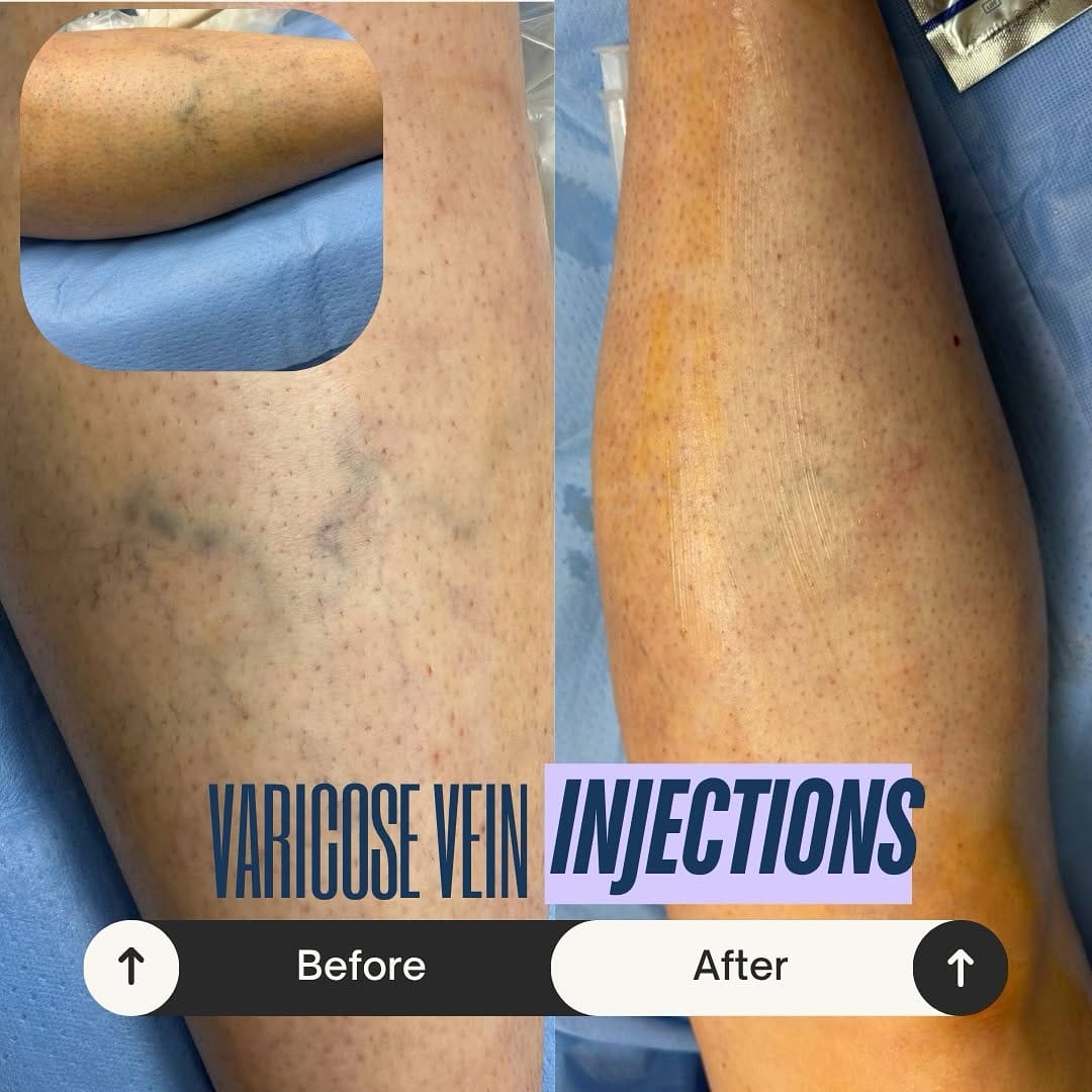 Post 8 by Rema Malik, MD, FACS, RPVI on Instagram (image)
