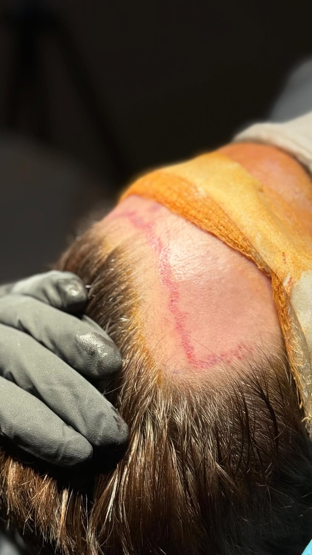 Post 8 by Jason Champagne, M.D. on Instagram (video)