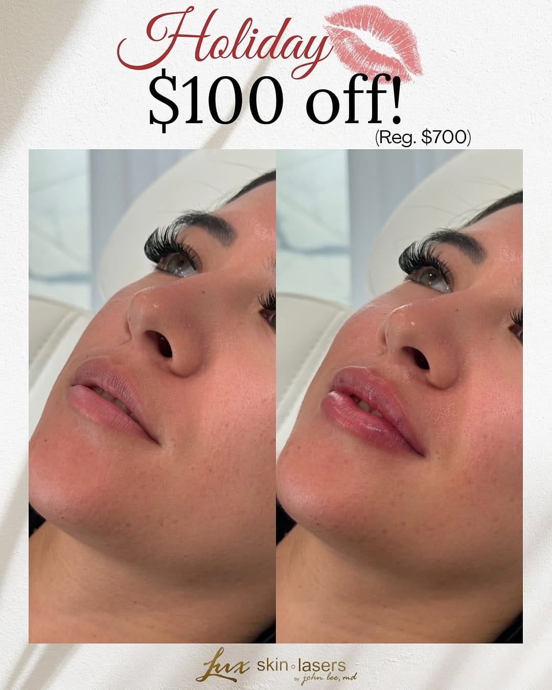 Post 7 by EYELIDS SURGERY • BOTOX • MEDSPA on Instagram (image)