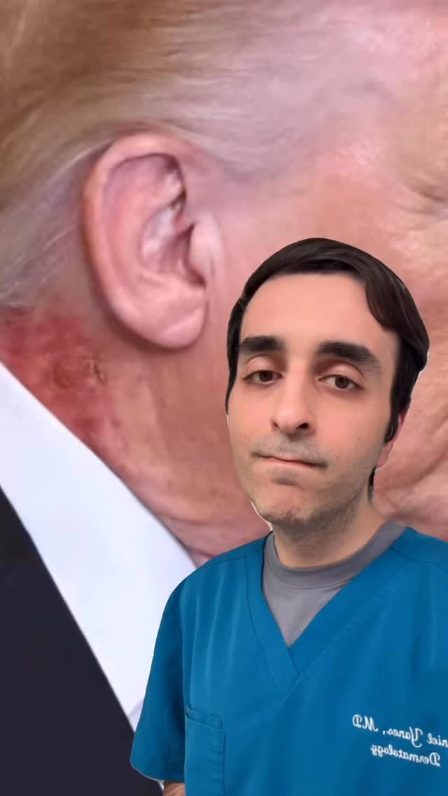 Post 1 by Daniel Yanes, MD, FAAD on Instagram (video)