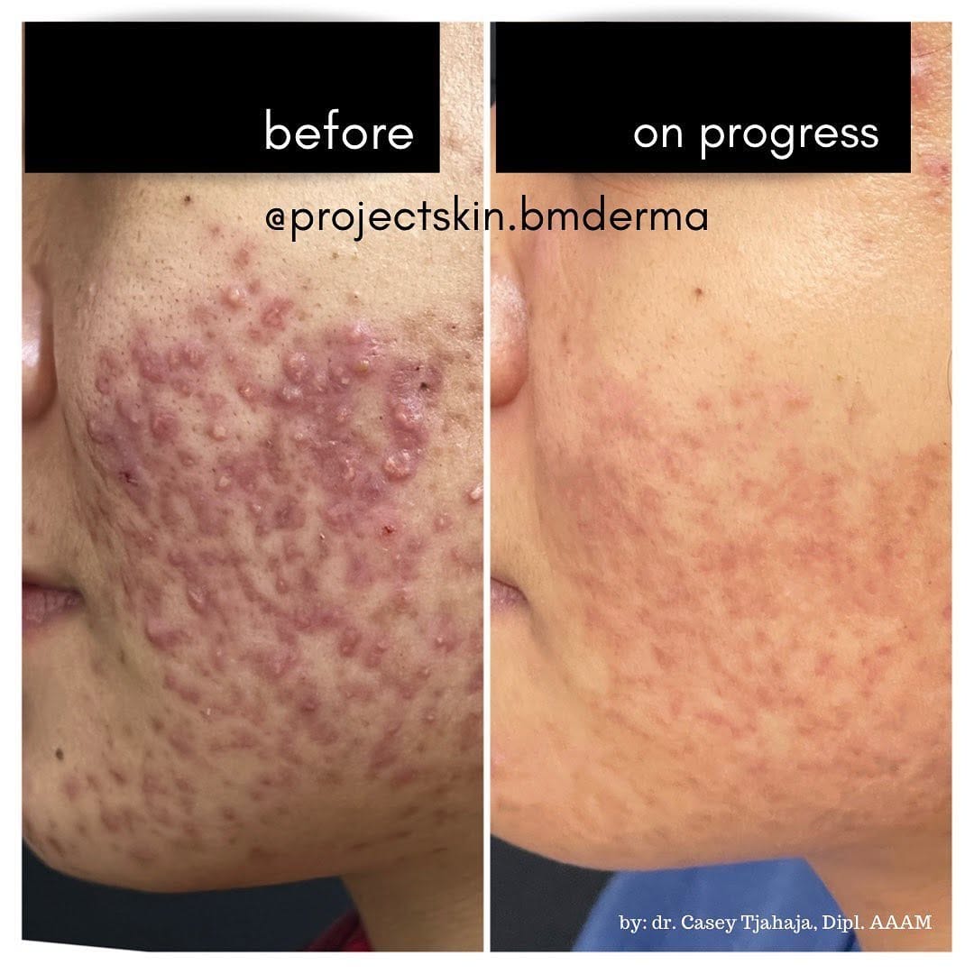 Post 9 by dr. casey tjahaja on Instagram (image)