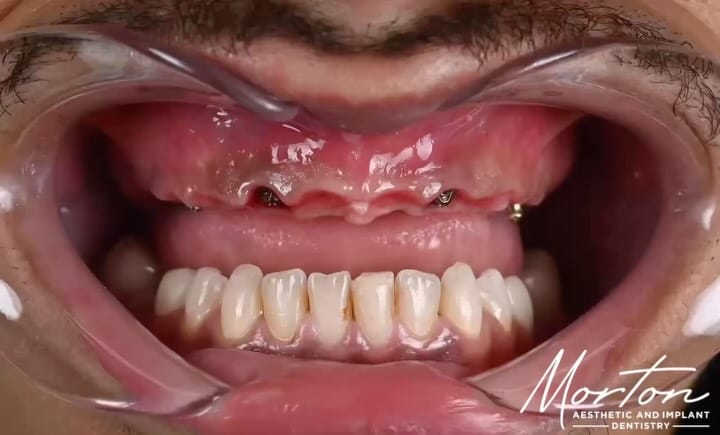 Post 7 by Skylor Morton-Nashville Dentist on Instagram (carousel)