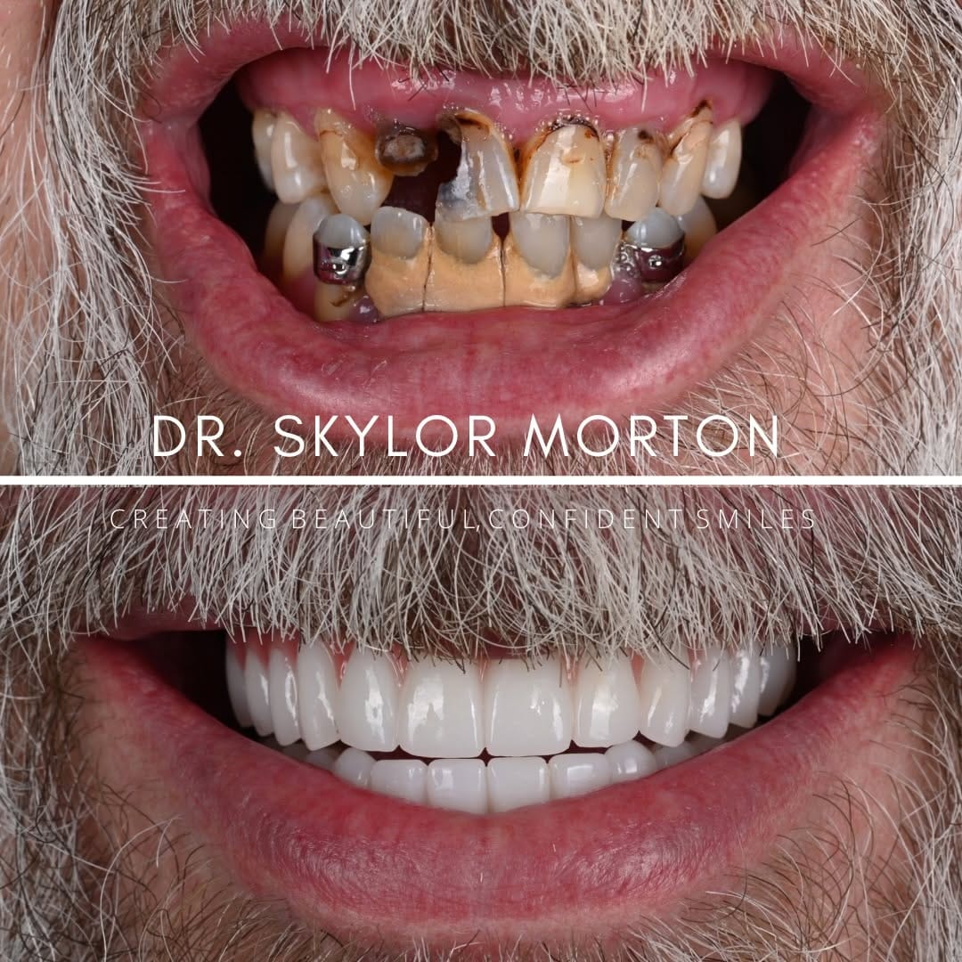 Post 9 by Skylor Morton-Nashville Dentist on Instagram (carousel)