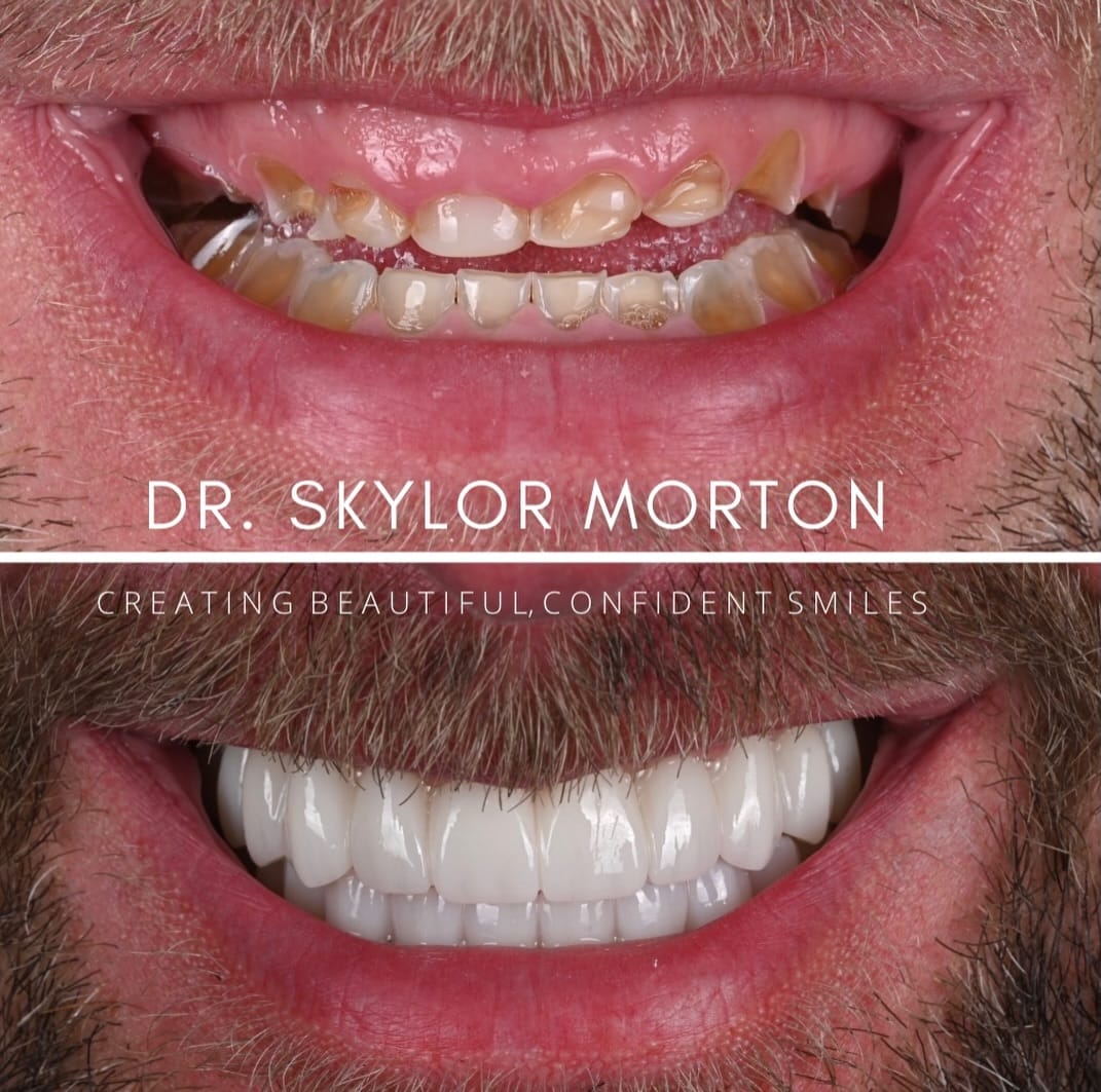 Post 3 by Skylor Morton-Nashville Dentist on Instagram (carousel)