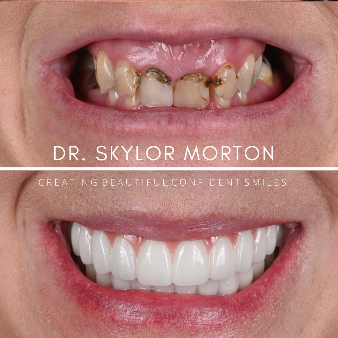 Post 2 by Skylor Morton-Nashville Dentist on Instagram (carousel)