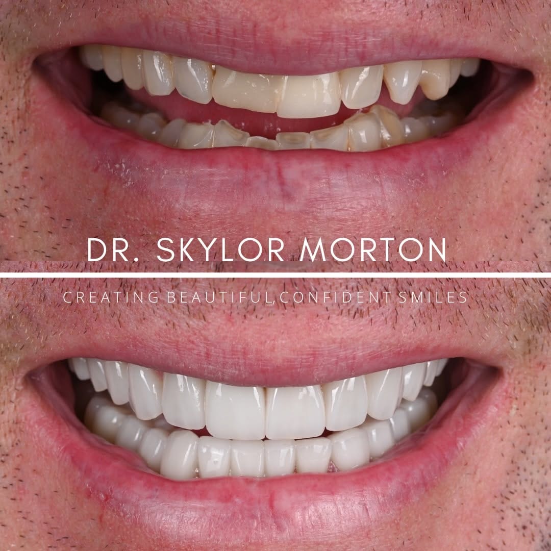 Post 5 by Skylor Morton-Nashville Dentist on Instagram (carousel)