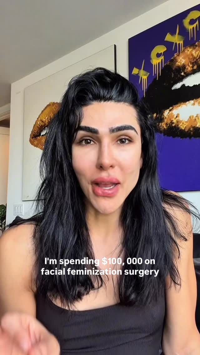 Post 8 by Harrison H Lee, MD, DMD, FACS on Instagram (video)