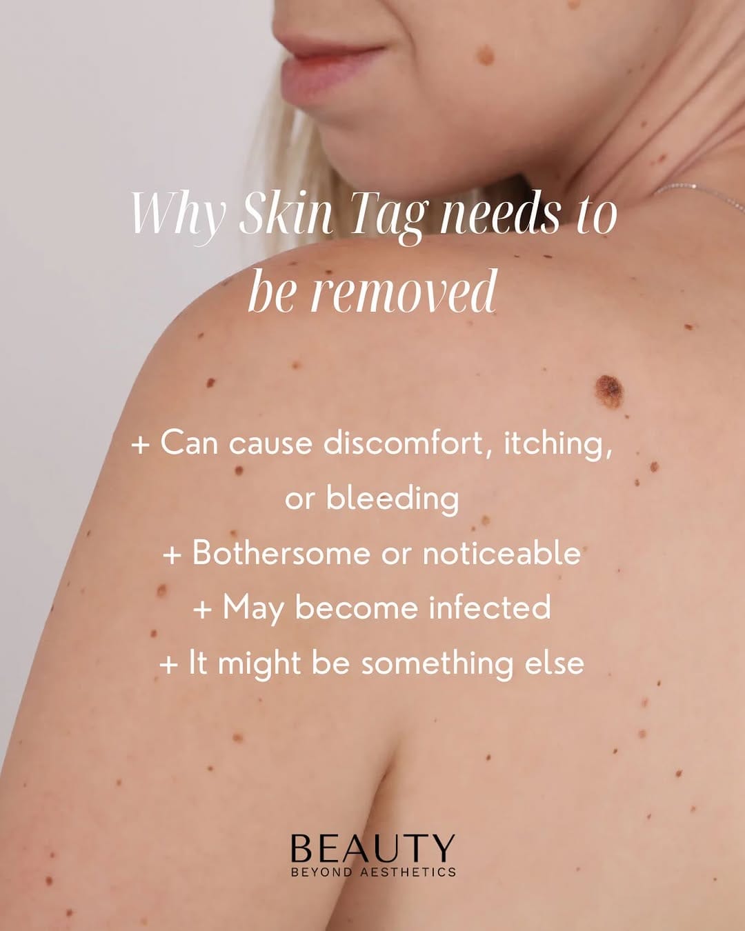Post 4 by Kristina / Beauty Aesthetics Lakeland MedSpa on Instagram (image)
