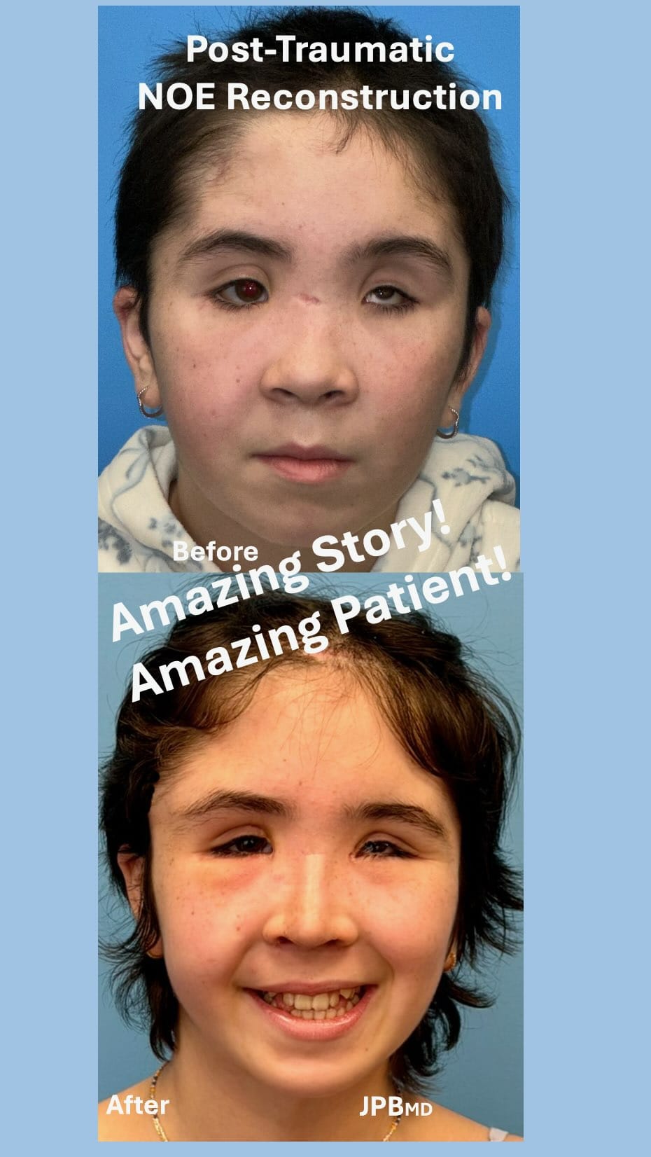 Post 6 by JAMES P. BRADLEY, MD on Instagram (video)