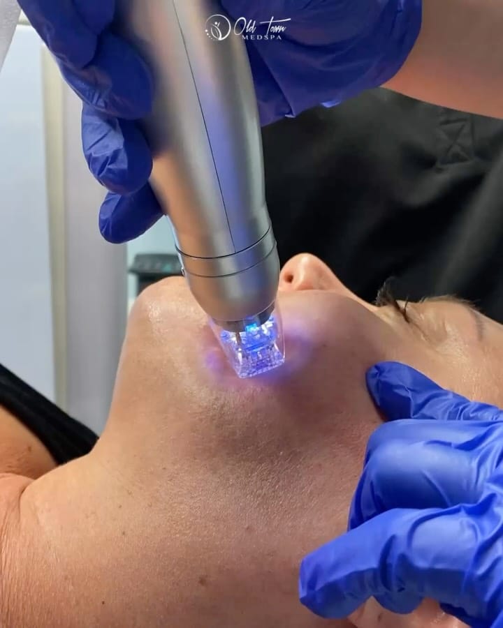 Post 6 by Old Town Med Spa on Instagram (carousel)