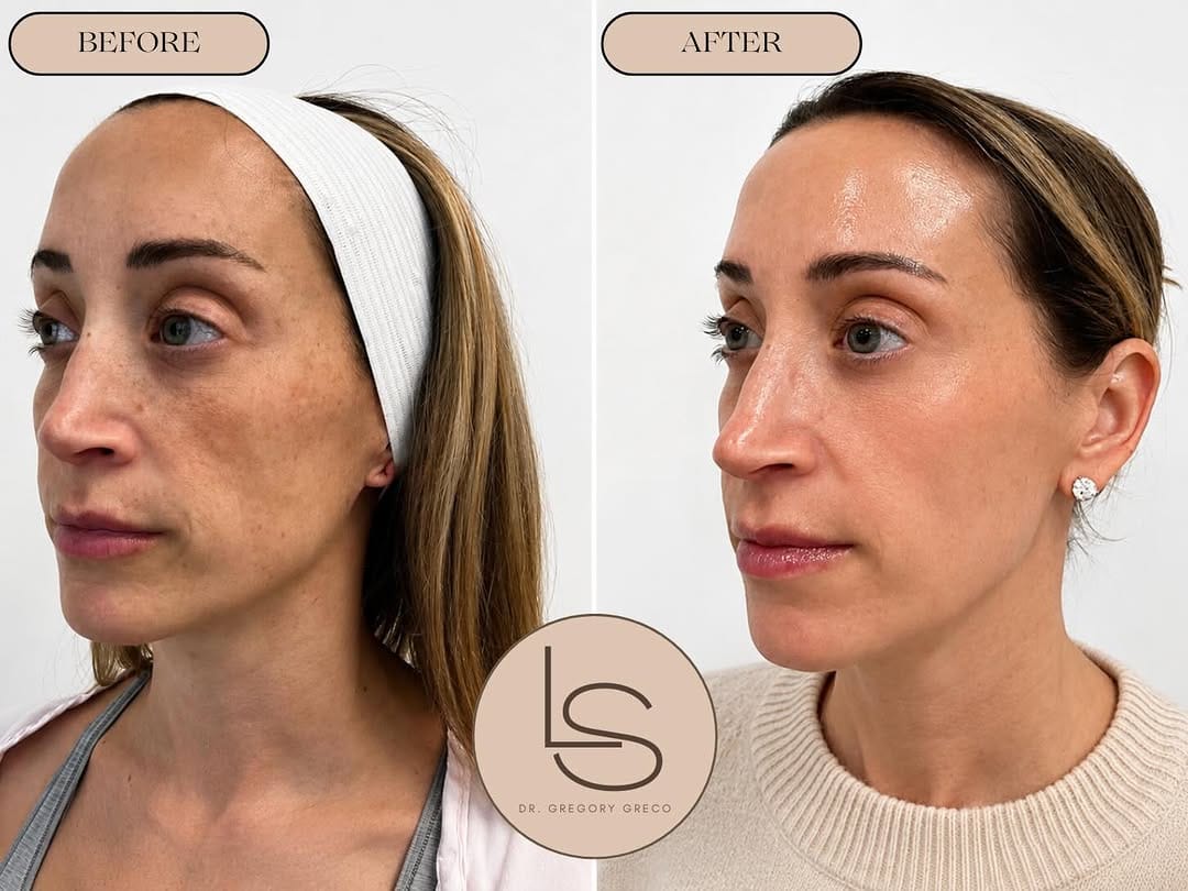 Post 3 by Dr. Gregory A. Greco, DO, FACS on Instagram (image)
