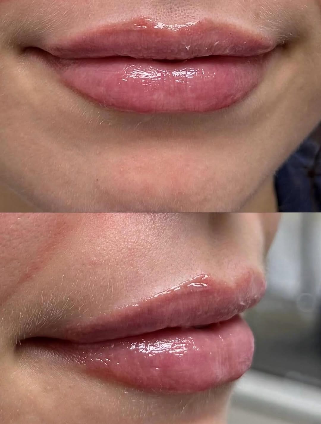 Post 9 by Premier Aesthetics on Instagram (image)