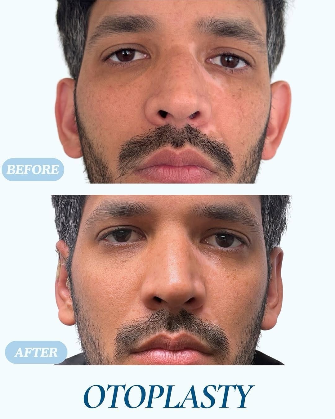 Post 4 by Cosmetic and Plastic Surgery | South Florida on Instagram (image)