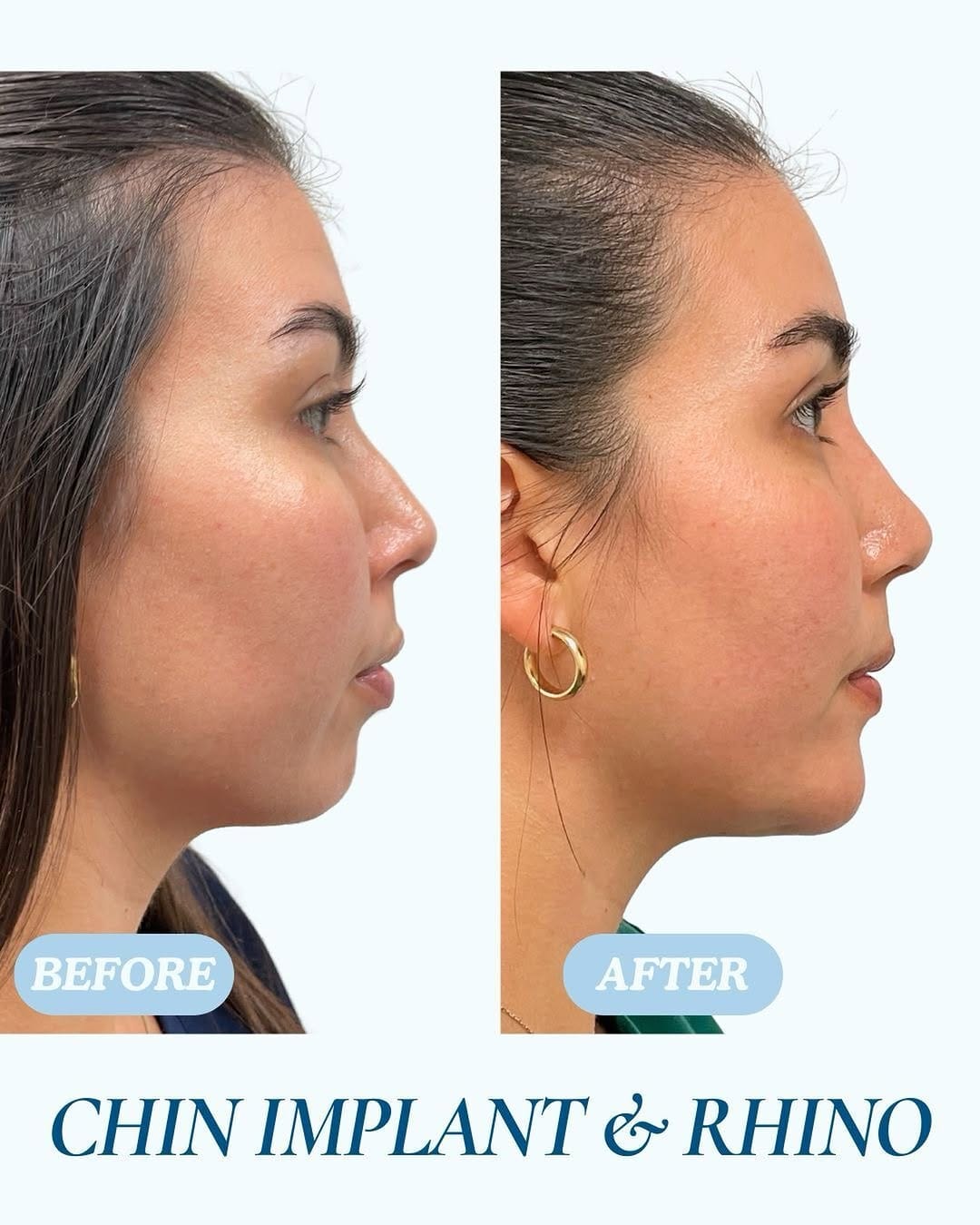 Post 7 by Cosmetic and Plastic Surgery | South Florida on Instagram (image)