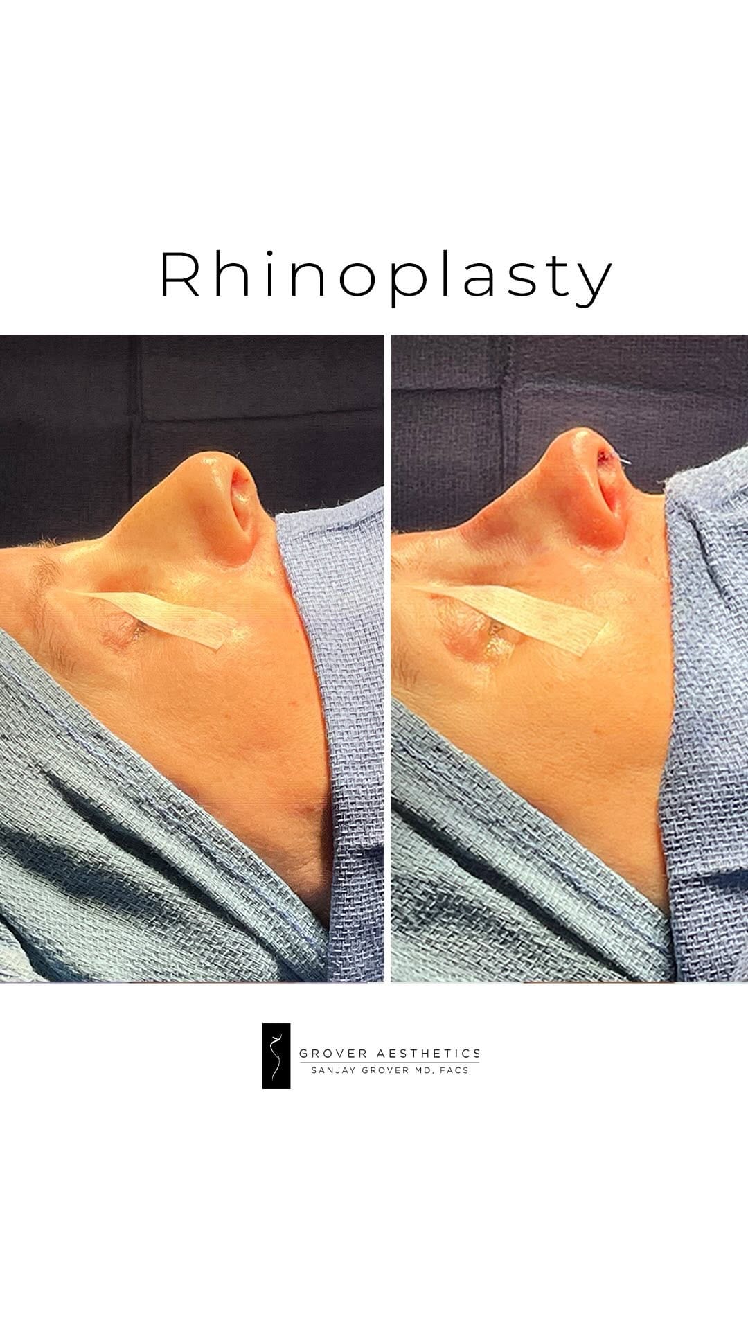 Post 6 by Sanjay Grover MD, FACS on Instagram (video)