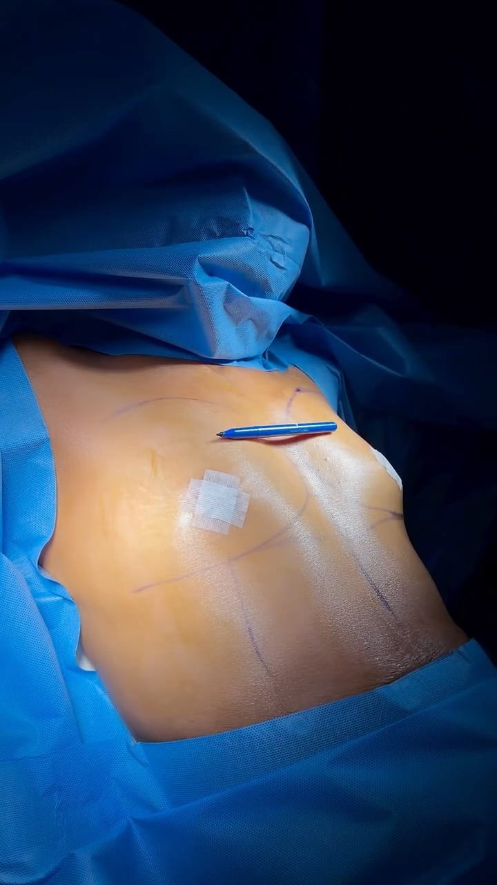 Post 9 by Designer Plastic Surgery & Med Spa on Instagram (video)