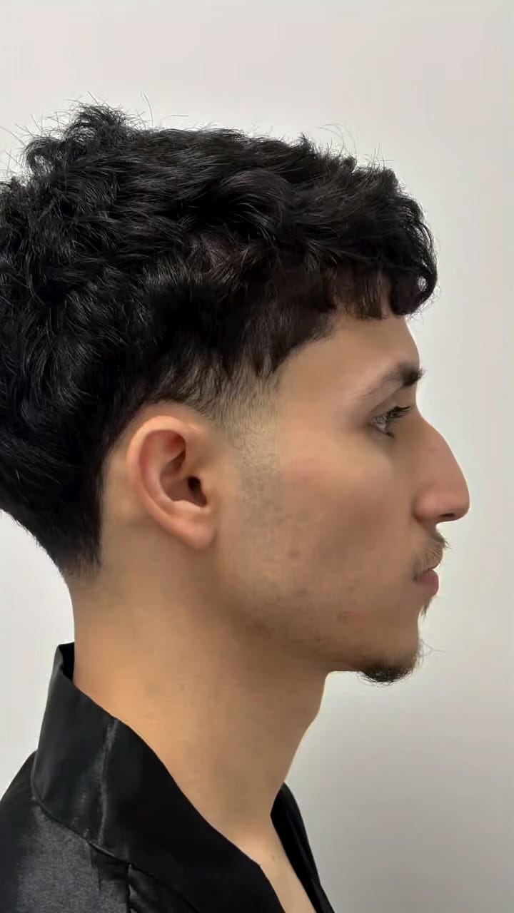 Post 5 by Designer Plastic Surgery & Med Spa on Instagram (video)