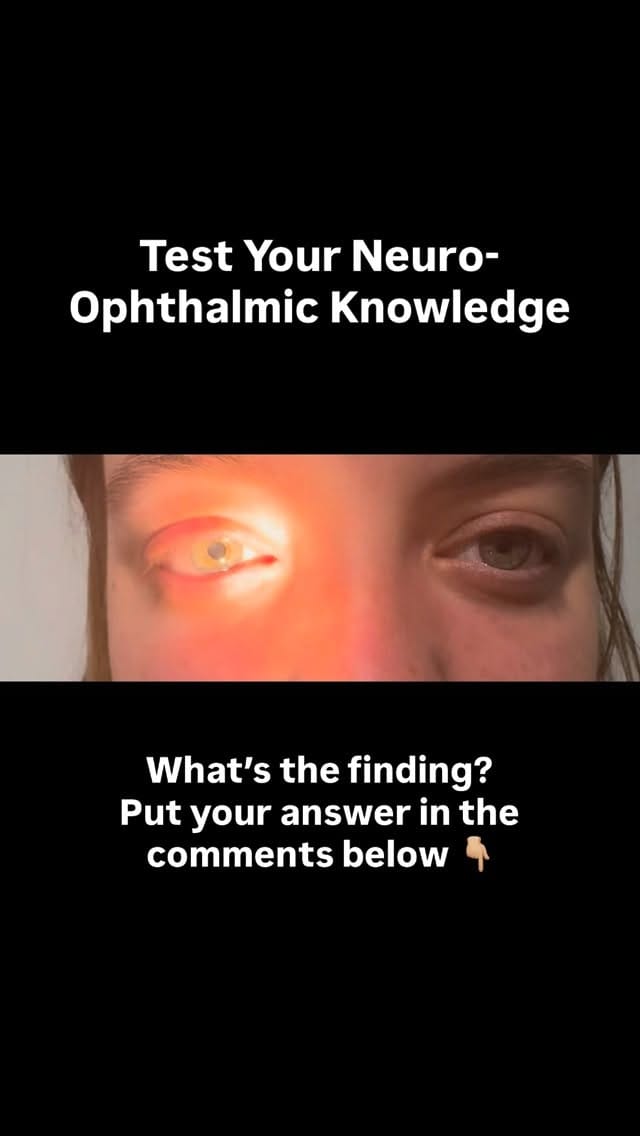 Post 6 by Rani Banik MD | Eye Doctor on Instagram (video)