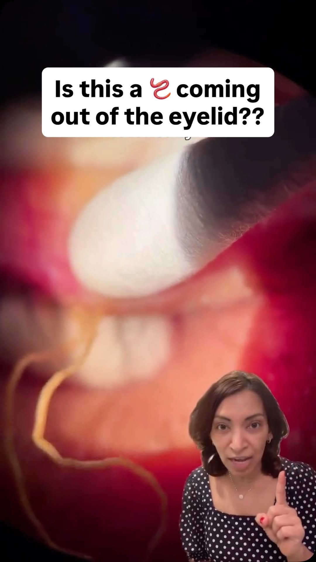 Post 9 by Rani Banik MD | Eye Doctor on Instagram (video)