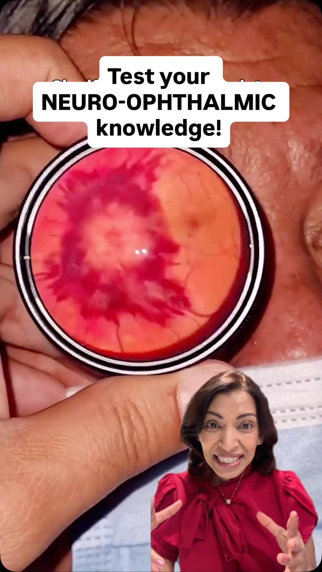 Post 8 by Rani Banik MD | Eye Doctor on Instagram (video)
