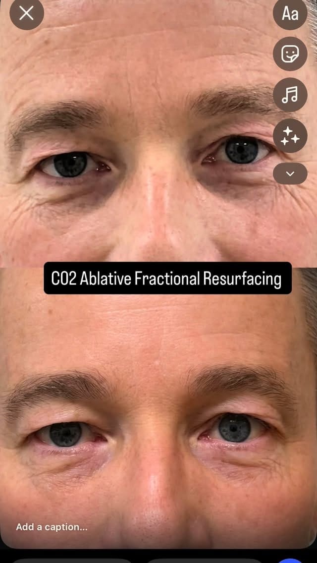 Post 3 by Mathew Avram MD on Instagram (video)