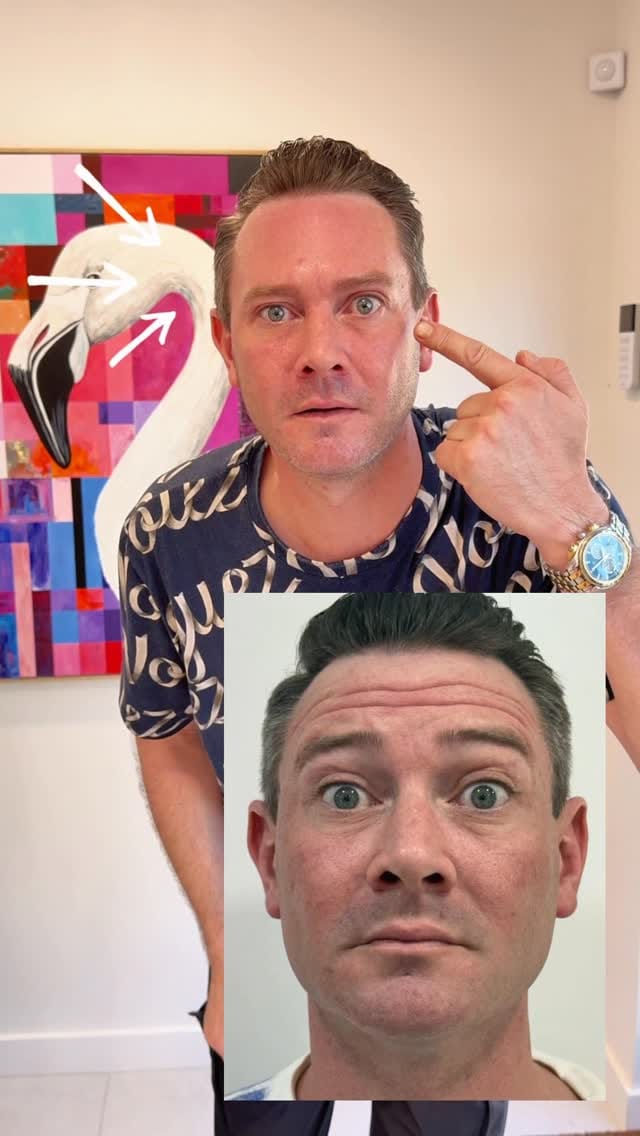 Post 4 by Le Spa Plastic Surgery | Doctor Michael Frederick on Instagram (video)