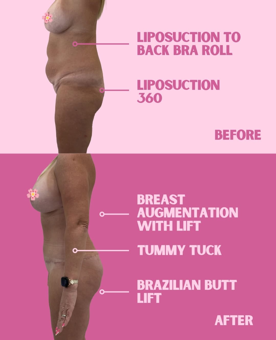 Post 3 by Le Spa Plastic Surgery | Doctor Michael Frederick on Instagram (carousel)