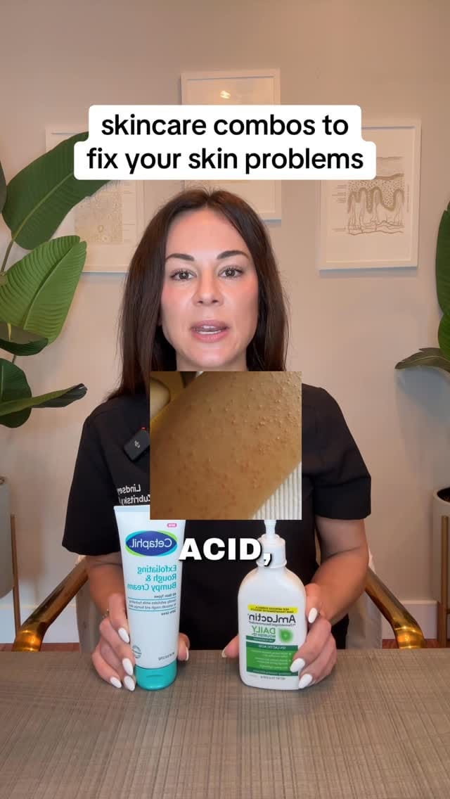 Post 4 by Lindsey Zubritsky, MD, FAAD on Instagram (video)